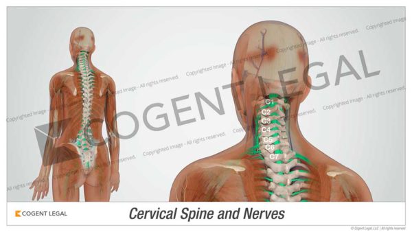 Cervical Spine and Nerves