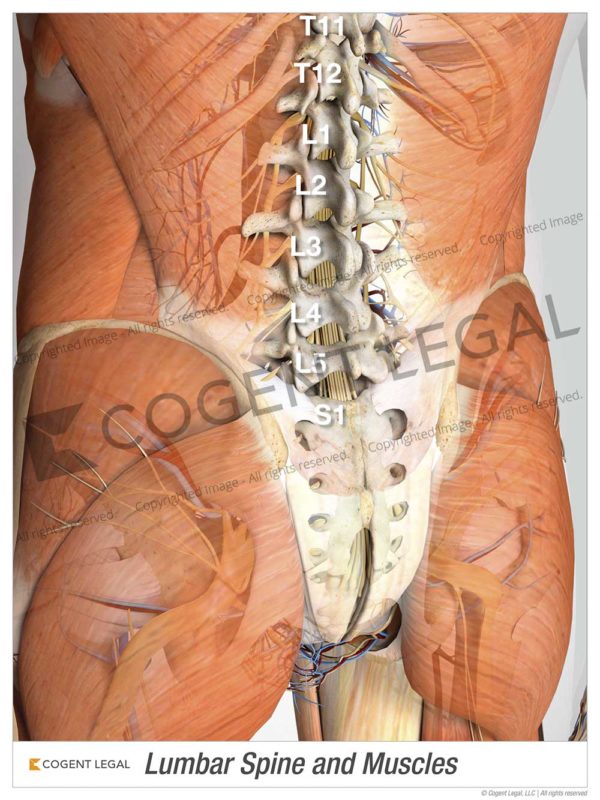 Lumbar Spine and Muscles