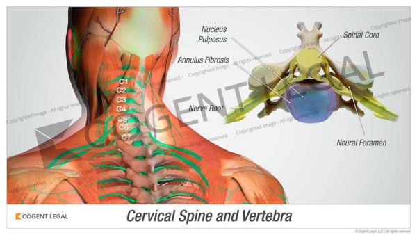 Cervical Spine and Vertebra