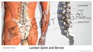 Lumbar Spine and Nerves
