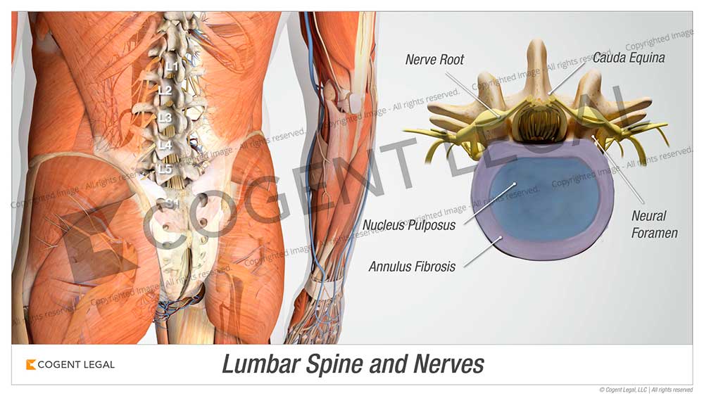 Lumbar Spine and Nerves - 6