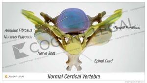 Cervical Vertebra
